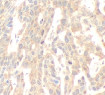 CAMKK2 Antibody