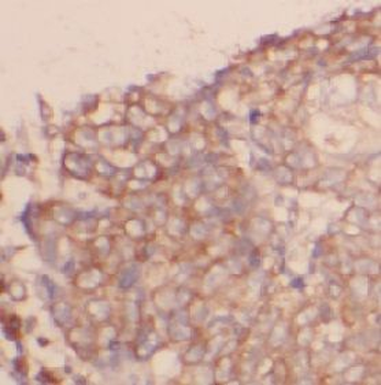 CNR1 Antibody