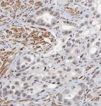 CAPG Antibody