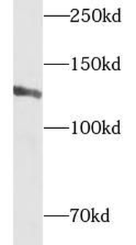 CAPRIN2 Antibody