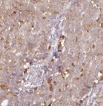 CAPZA1 Antibody