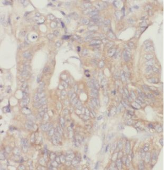 CAPZA2 Antibody