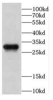 CAPZB Antibody