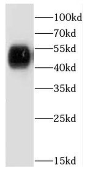 CPA1 Rabbit Polyclonal Antibody