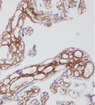 CPA1 Rabbit Polyclonal Antibody