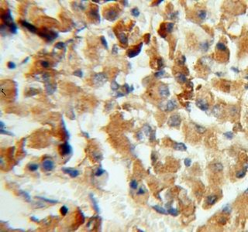 CPE Antibody