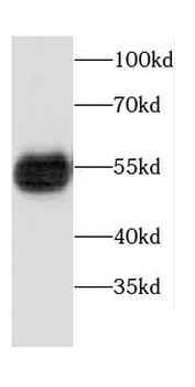 CPM Rabbit Polyclonal Antibody