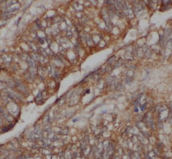 CARD11 Antibody