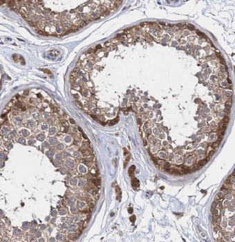 CARD6 Antibody