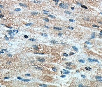 TNNT2 Antibody