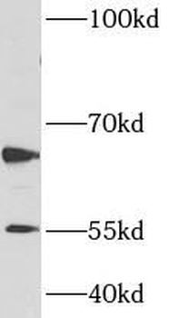 CARM1 Antibody