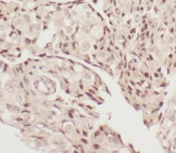 CARM1 Antibody