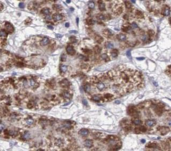 CAT Rabbit Polyclonal Antibody