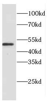 CTSD Antibody