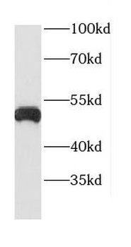 CTSD Antibody