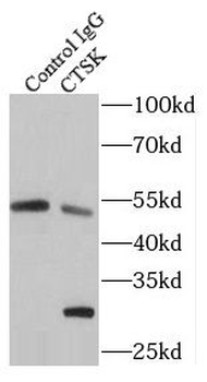 CTSK Antibody