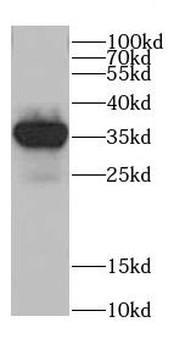 CTSV Rabbit Polyclonal Antibody