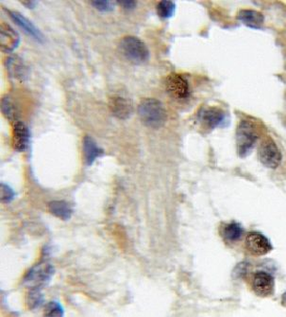CBFA2T2 Antibody
