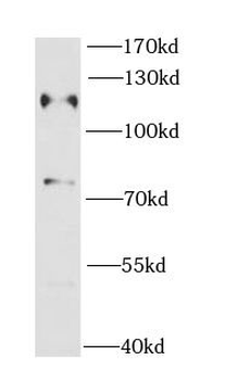CBL Rabbit Polyclonal Antibody