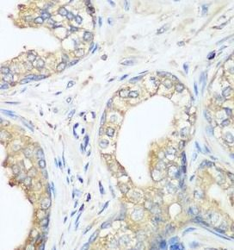 CBL Rabbit Polyclonal Antibody