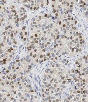 CBLL1 Antibody