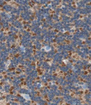 CBLN4 Antibody