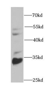 CBR3 Antibody