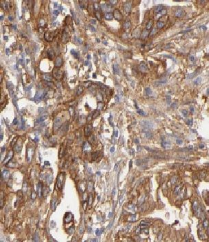 CBS Antibody