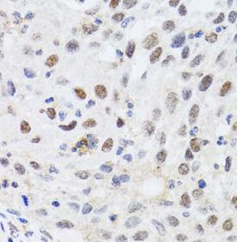 CBX4 Antibody