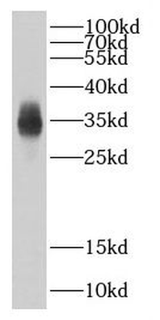 CBY1 Antibody