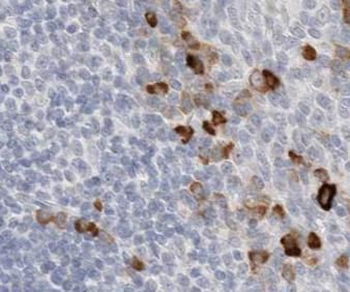 ACKR2 Rabbit Polyclonal Antibody