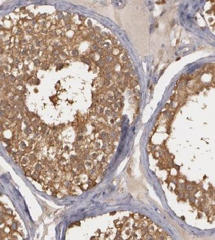 TEKTL1 Rabbit Polyclonal Antibody
