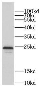CCDC115 Antibody