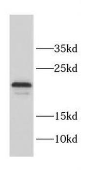 CCDC12 Antibody