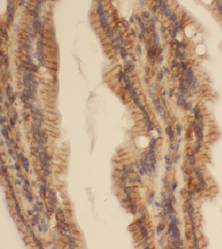 CCDC120 Antibody