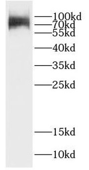 CCDC27 Antibody