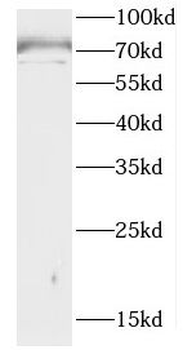 CCDC28A Rabbit Polyclonal Antibody