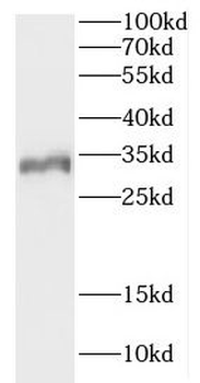 CCDC28B Antibody