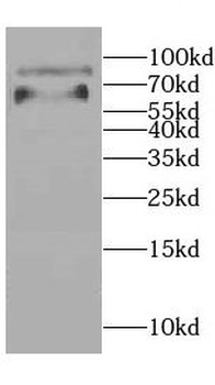 CEP83 Antibody