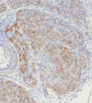 CCDC51 Antibody