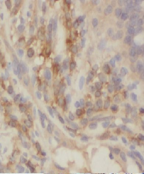 CCDC93 Antibody
