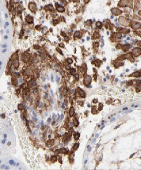 YJU2 Antibody