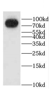 CCHCR1 Rabbit Polyclonal Antibody