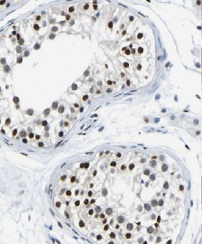 CCHCR1 Rabbit Polyclonal Antibody
