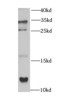 CCL17 Antibody