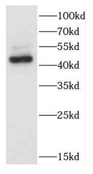 CCNL1 Rabbit Polyclonal Antibody