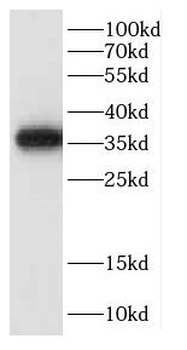 CCNY Antibody