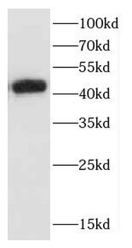 CCR10 Rabbit Polyclonal Antibody