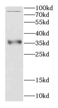 CCS Rabbit Polyclonal Antibody