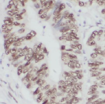 CCT3 Antibody